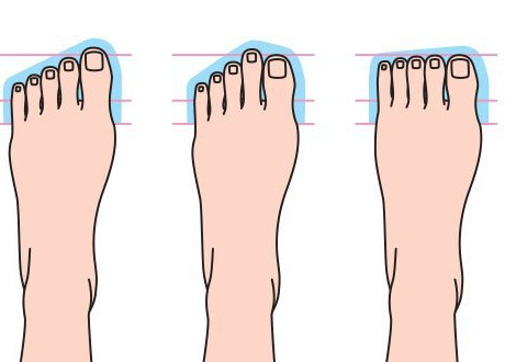 Quels sont les différents types de pieds ?